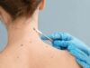 Aumentan en el mundo casos de cáncer de piel en los jóvenes